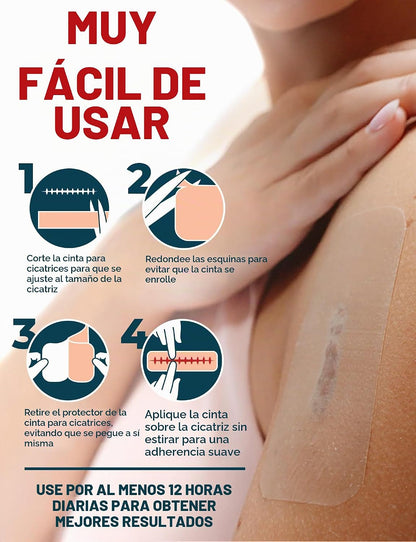 Cinta de Silicona ReparaCicatriz Pro