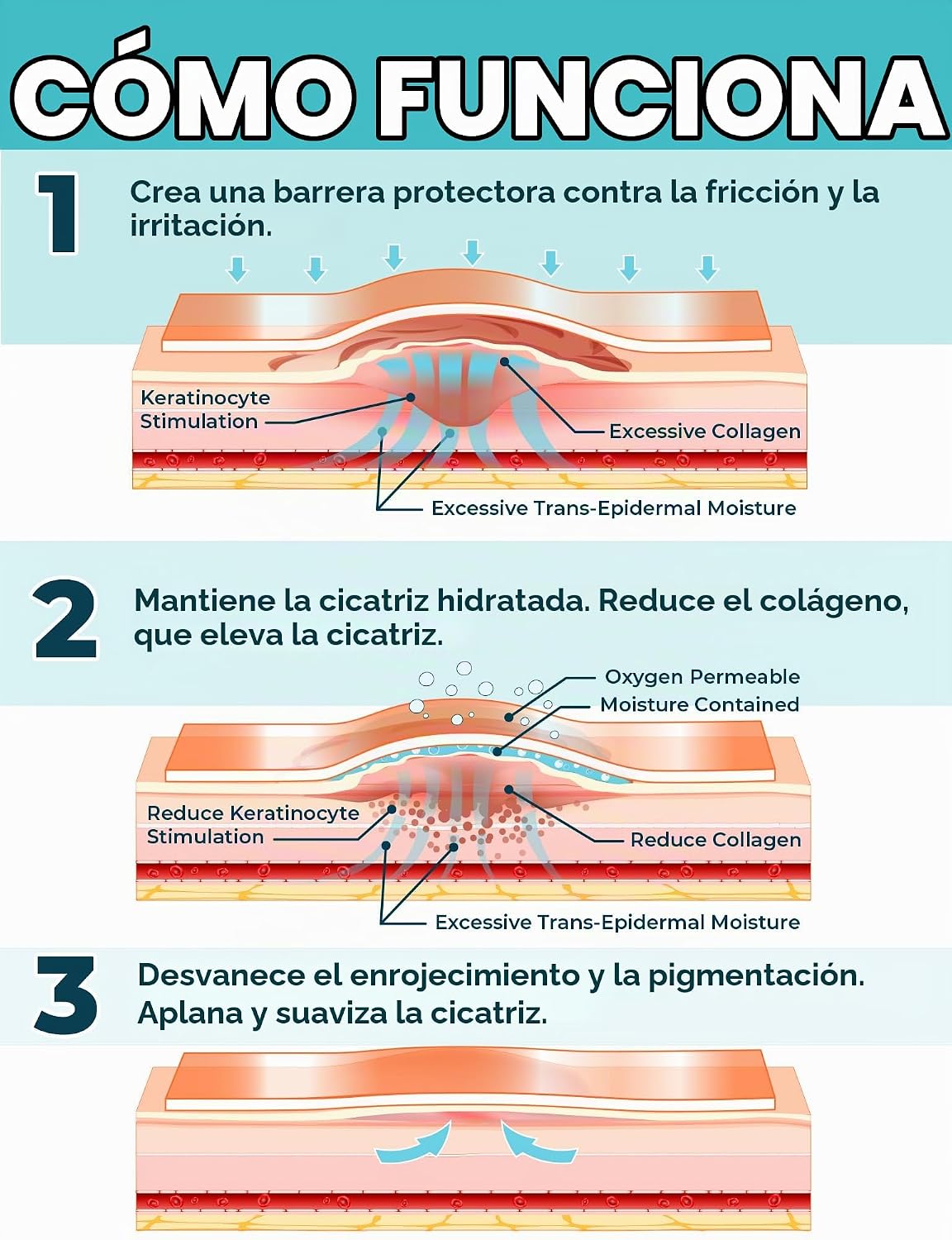 Cinta de Silicona ReparaCicatriz Pro