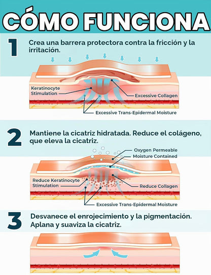 Cinta de Silicona ReparaCicatriz Pro