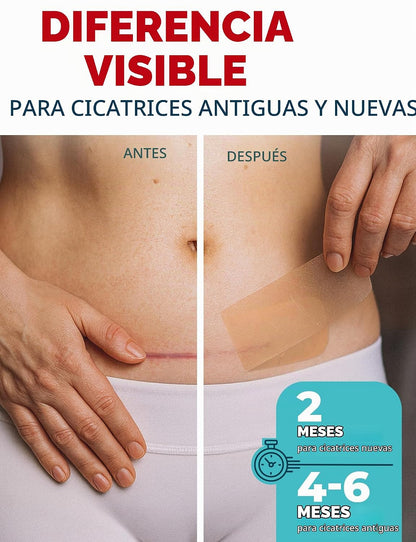 Cinta de Silicona ReparaCicatriz Pro