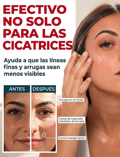 Cinta de Silicona ReparaCicatriz Pro