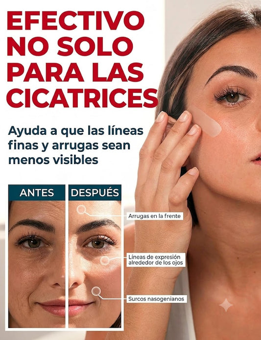 Cinta de Silicona ReparaCicatriz Pro